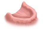 Image of a mouth without teeth